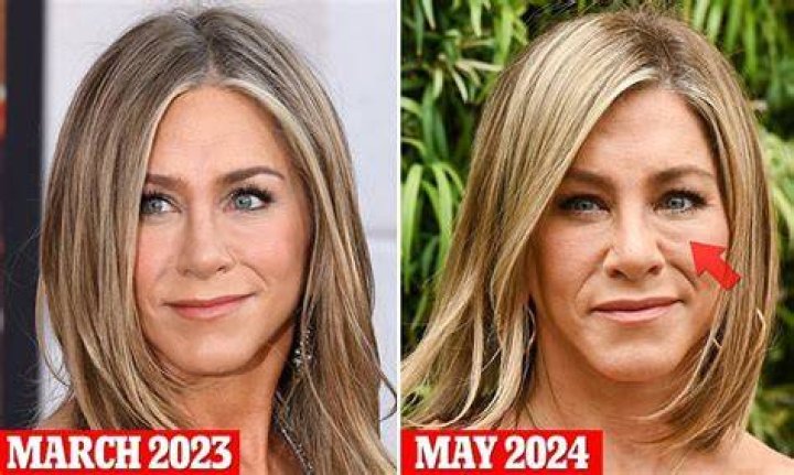 Has Jennifer Aniston Had Cosmetic Surgery?