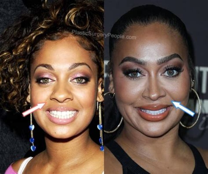 Lala Anthony Before And After Butt Implants