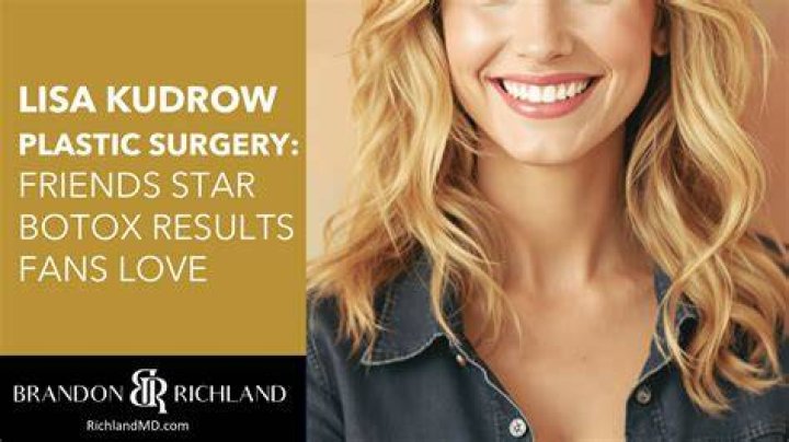 Lisa Helou’s Plastic Surgery Has the Selling the OC Cast Undergone